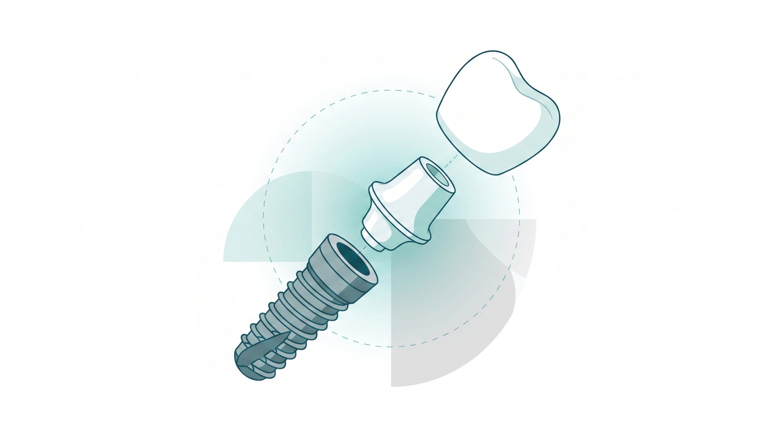 A premium editorial vector illustration showing a calm adult patient and dentist in consultation beside a natural white dental arch, a ceramic crown shape and an implant form, with generous white space and fine deep teal linework.