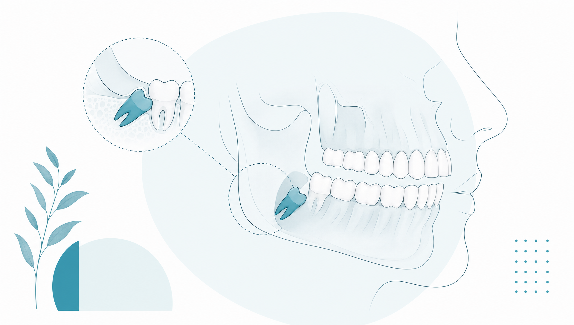 Premium editorial vector illustration of a clean side-view jaw with the lower wisdom tooth subtly highlighted, mostly white space, natural ivory tooth tones and fine deep teal linework with restrained teal accents in the background.